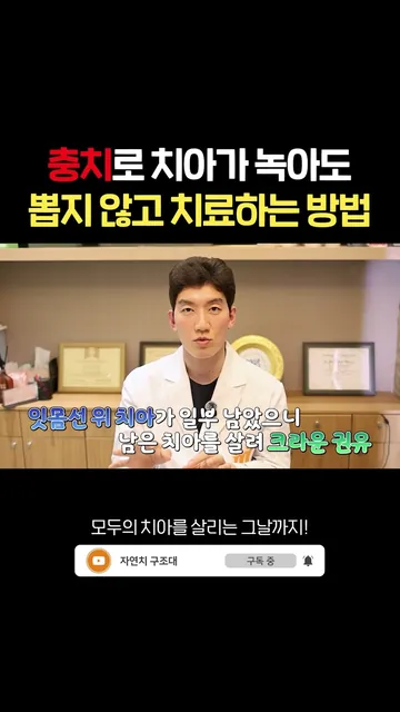 충치로 치아가 녹아도 뽑지 않고 치료할 수 있다고?